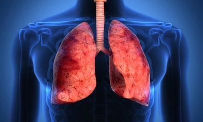 Celnova - enfermedad respiratoria